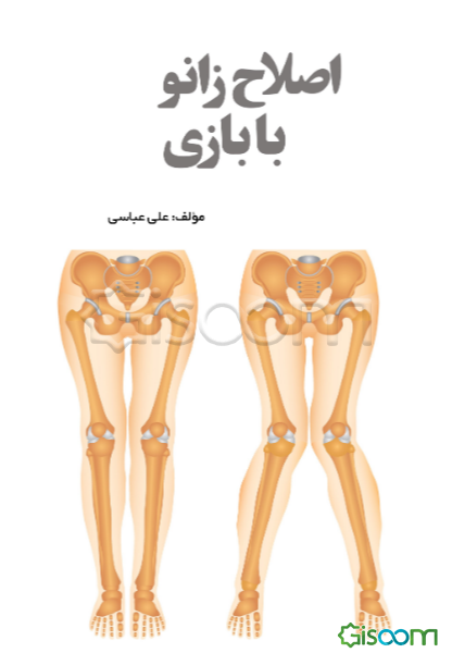 اصلاح زانو با بازی