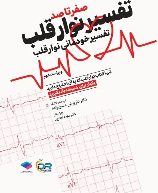 صفر تا صد تفسیر نوار قلب: تفسیر خودمانی نوار قلب