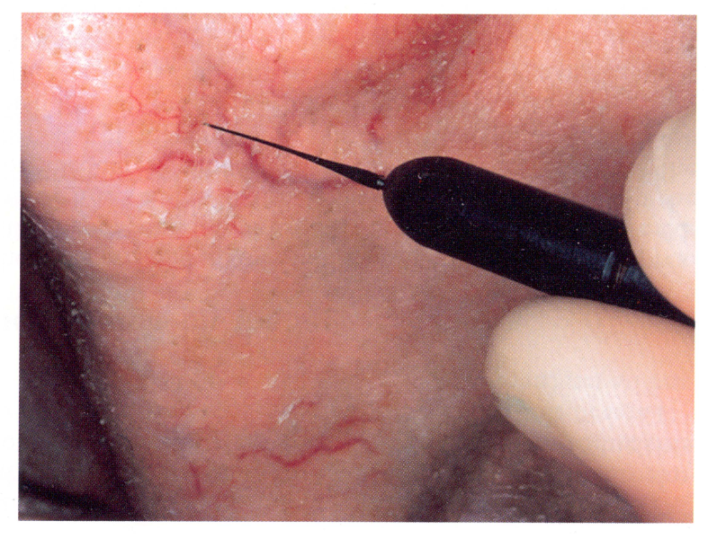 مراقبت و زیبایی پوست