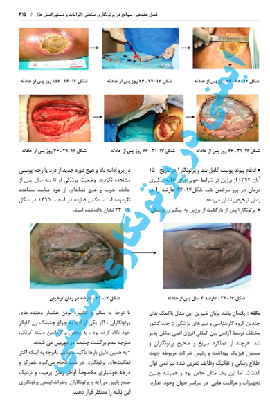 ایمنی در پرتونگاری صنعتی